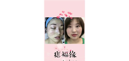 痣福缘：好的形象能给你带来什么好处……