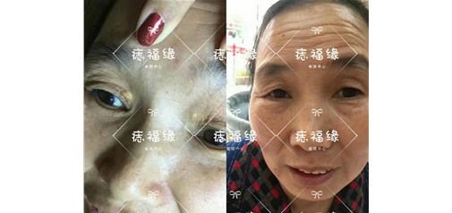 痣福缘：痣福缘一直在，与您同行，为您服务！
