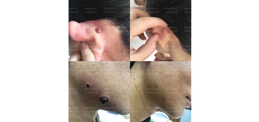 痣福缘：取痣斑痘疣是痣福缘人一生的使命，脚‎踏‎实地 用时间的磨‎砺‎去‎沉淀! 