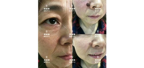 痣福缘：全国连锁取痣服务与痣文化研究机构！