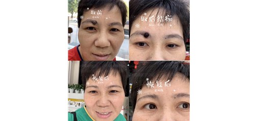 痣福缘：全国连锁取痣服务与痣文化研究机构！