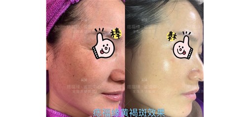 痣福缘：干净为美！